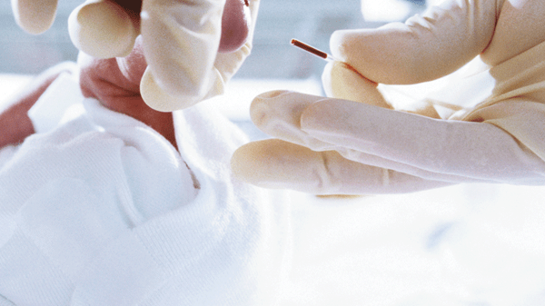 クリニチューブ(キャピラリーチューブ)