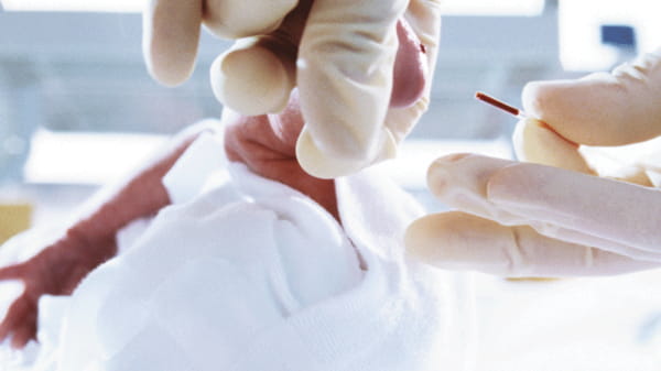 クリニチューブキャピラリーの使用中の画像