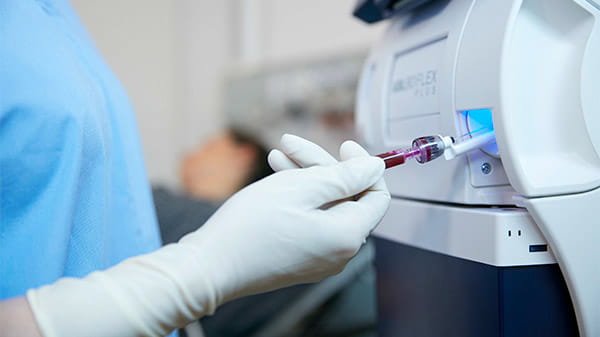 ラジオメーターの ABL90 分析装置による測定