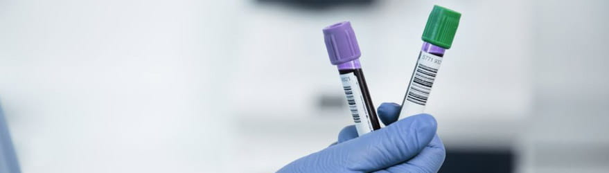 D -ダイマーとプロカルシトニンの概要