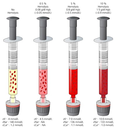 An example of a hemolyzed blood sample: