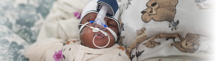 経皮血液ガスモニタ TCM5 FLEX