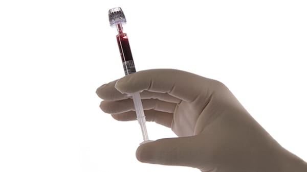 Aライン採血用の血液ガスシリンジ safePICO Aspirator